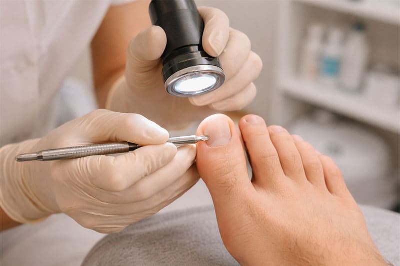 Podóloga Josy realizando avaliação técnica detalhada na lâmina ungueal de um paciente em consultório.