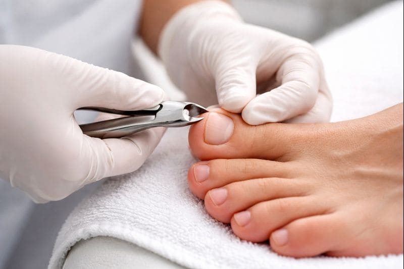 podóloga tratando unha encravada