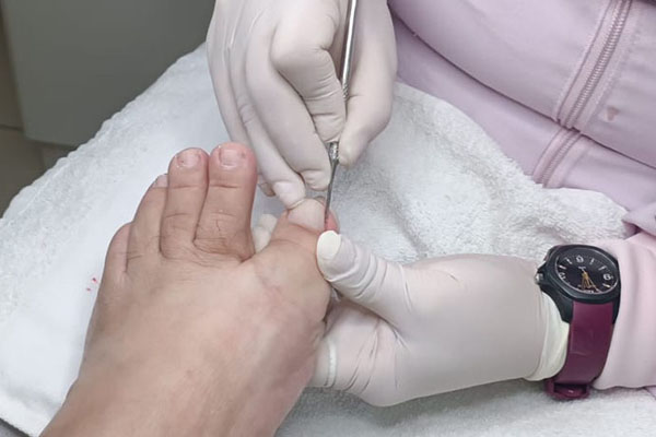 Tratamento podológico profissional em ambiente seguro e higienizado